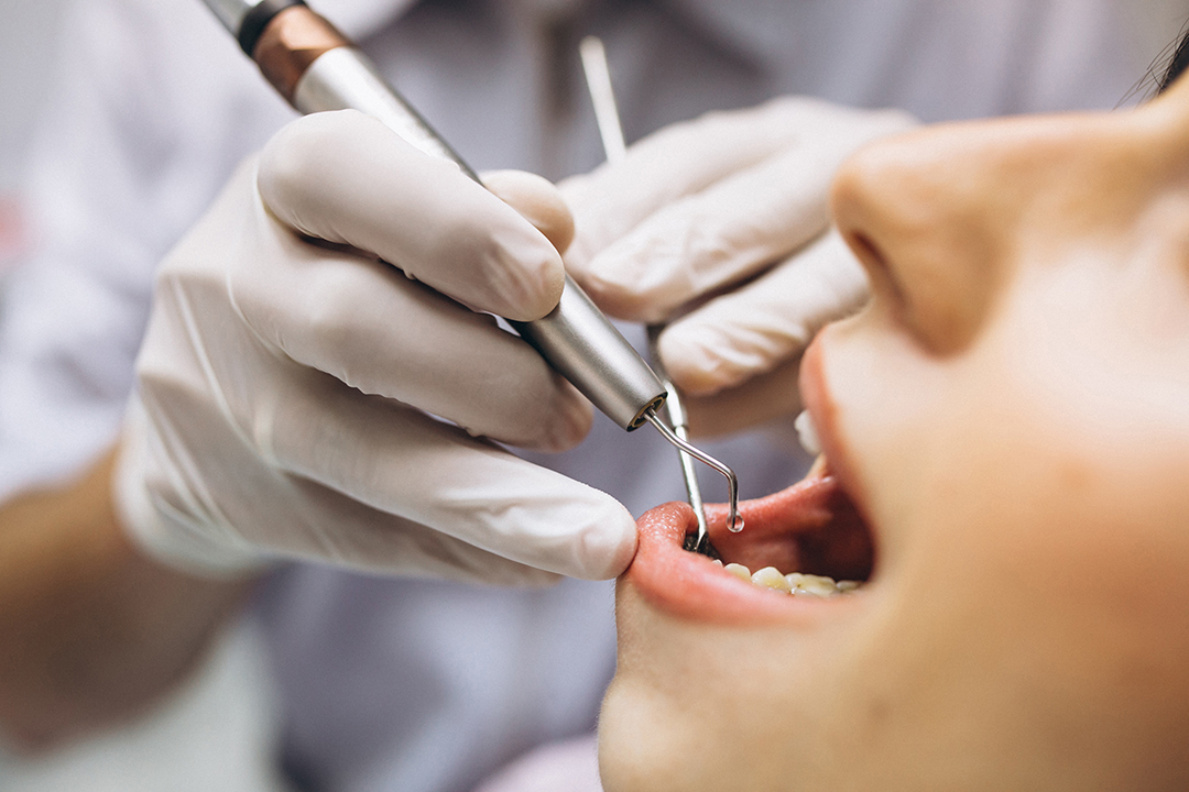 植牙手術前需做病患條件評估
