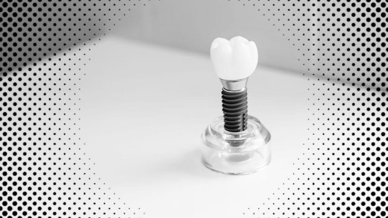 解構植體設計：形式、機制、材質，牙醫師不可錯過的植牙 101