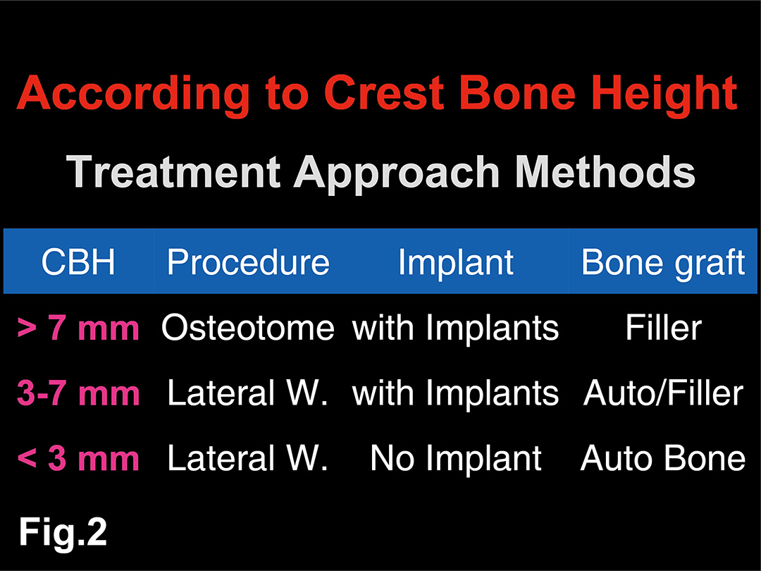 Fig. 2 Crest Approach 做 Sinus Lift 的限制大都著重在 Crest Bone Height（CBH）
