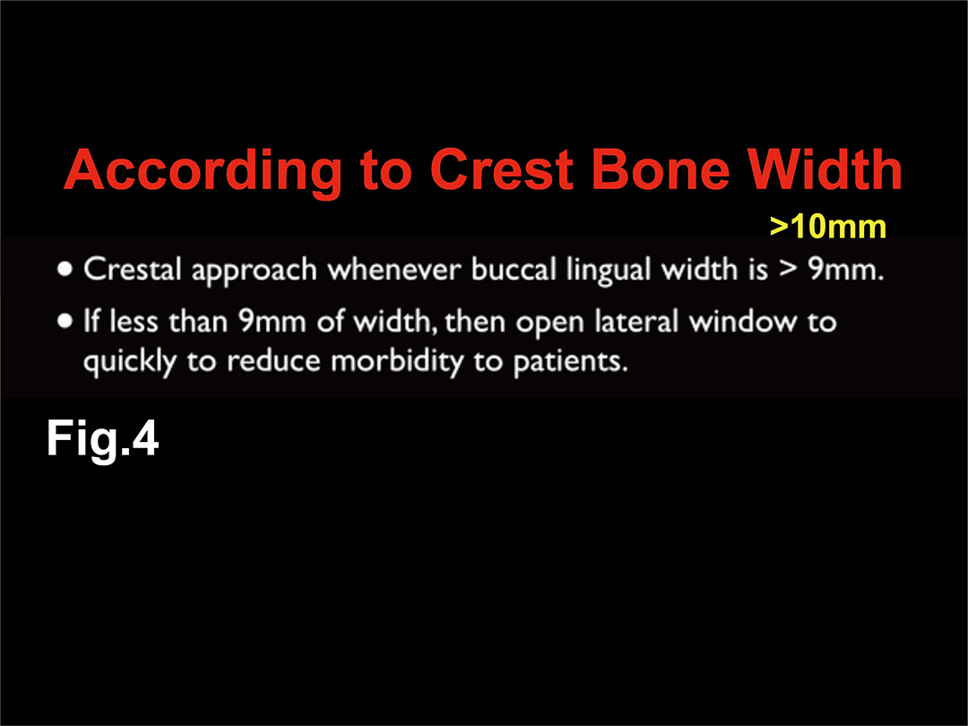 Fig. 4 方鍾鼎醫師將 Crest Bone Width（CBW）的界限定在 9mm